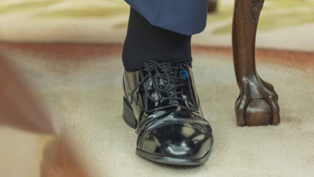 Trump Diagnosed with Chronic Venous Insufficiency